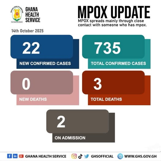 Ghana records 22 new Mpox cases; total infections hit 735 — GHS